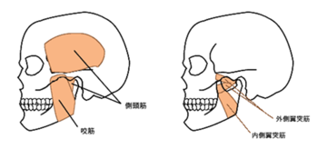 顎関節症２.png