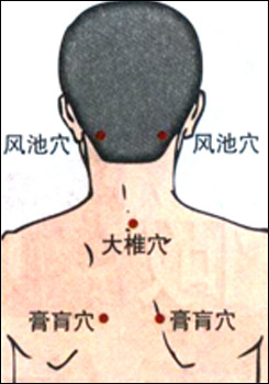 首肩こり（風池・大椎・膏肓）.jpg