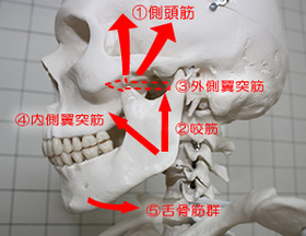 顎関節症６.jpg