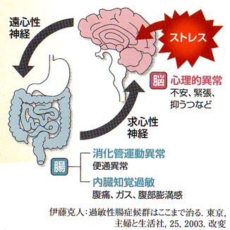 過敏性腸症候群３.gif